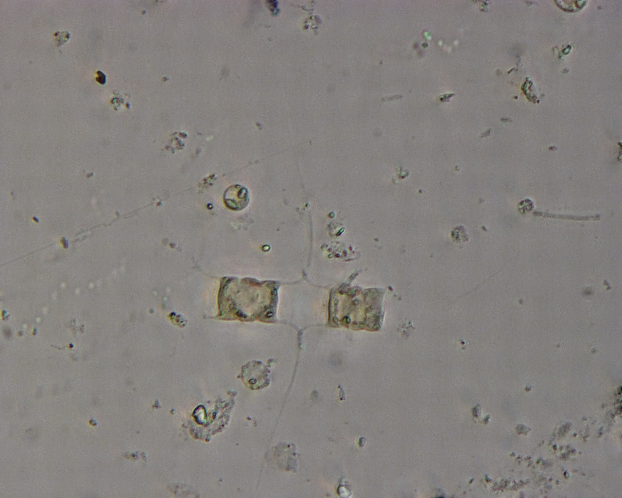 Dictyocha speculum